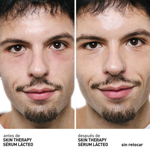 Vista 4/10 de Skin Therapy S&eacute;rum L&aacute;cteo, , ES